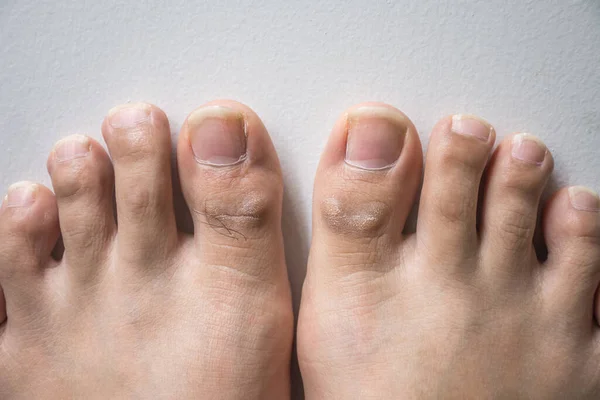 Voet Lange Nagel Tenen Witte Betonnen Achtergrond Lange Nagels Vuil — Stockfoto