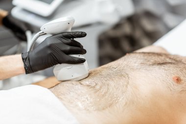 Erkek bir müşteri için ultrason liposuction prosedürü