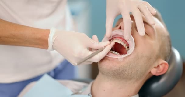 Paciente con aparatos dentales durante una visita regular a la ortodoncia — Vídeos de Stock