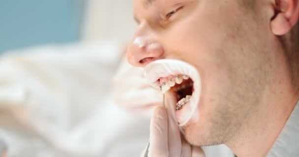 Dentiste et patient pendant un traitement orthodontique — Video