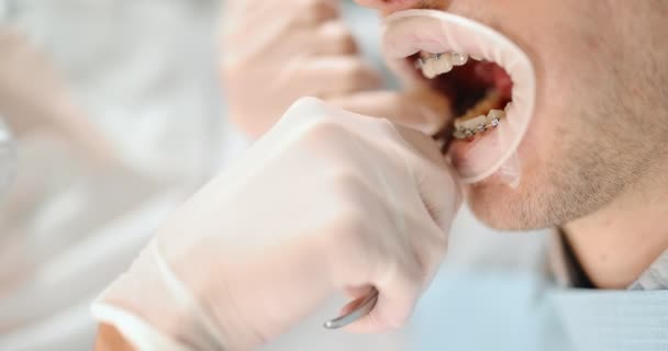 Dentista y paciente durante un tratamiento de ortodoncia — Vídeos de Stock