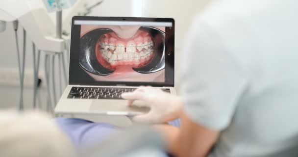 Tandläkare visar foto av tänder på en bärbar dator för en ung patient — Stockvideo