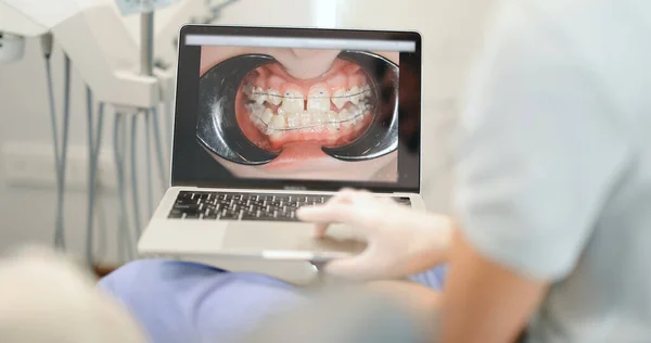 牙医在手提电脑上为一位年轻病人展示牙齿照片 — 图库照片
