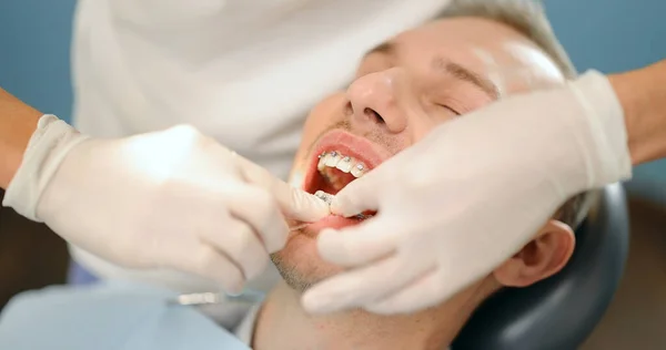 Ortodontista substituindo ligaduras em aparelho dentário no consultório odontológico — Fotografia de Stock