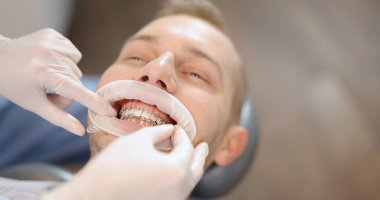 Ortodonti tedavisi sırasında diş teli takan hasta.