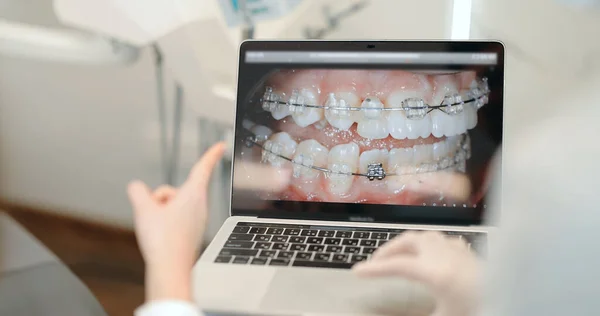 若い患者のためのラップトップ上の歯の写真を示す歯科医 — ストック写真