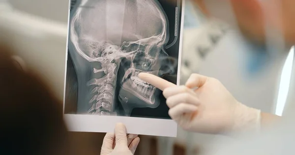Tannlege som viser røntgen av en skalle for en ung pasient – stockfoto