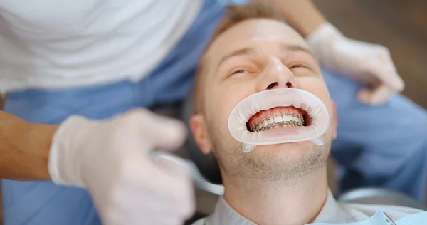 Paciente con aparatos dentales durante un tratamiento de ortodoncia — Foto de Stock