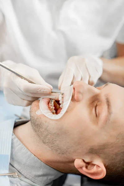 Пациент с зубными скобками во время регулярного ортодонтического визита — стоковое фото