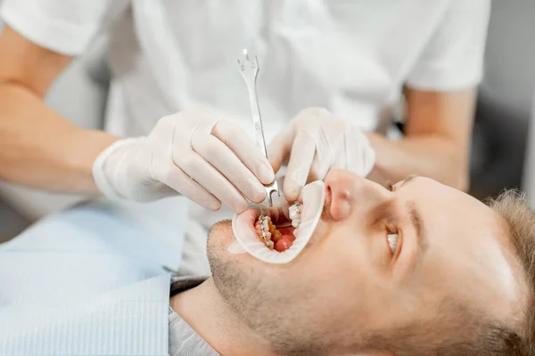 Paciente con aparatos dentales durante una visita regular a la ortodoncia — Foto de Stock