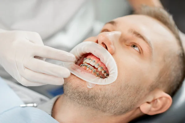 Pacjent z aparatem ortodontycznym podczas regularnej wizyty ortodontycznej — Zdjęcie stockowe