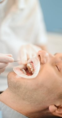 Ortodontik tedavi sırasında dişçi ve hasta