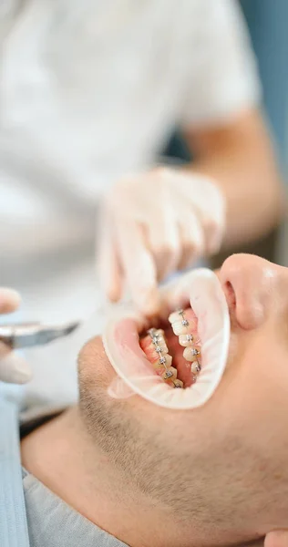 Стоматолог і пацієнт під час ортодонтичного лікування — стокове фото
