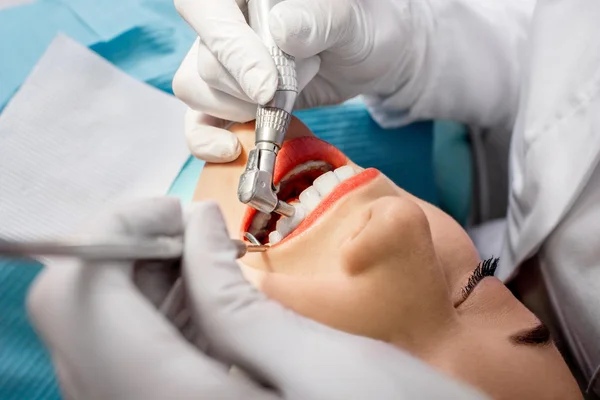 プロの歯のクリーニング — ストック写真