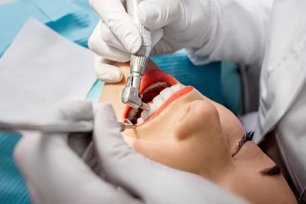 Professional teeth cleaning — Stock Photo, Image