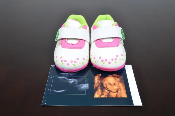 超音波画像の赤ん坊靴 — ストック写真