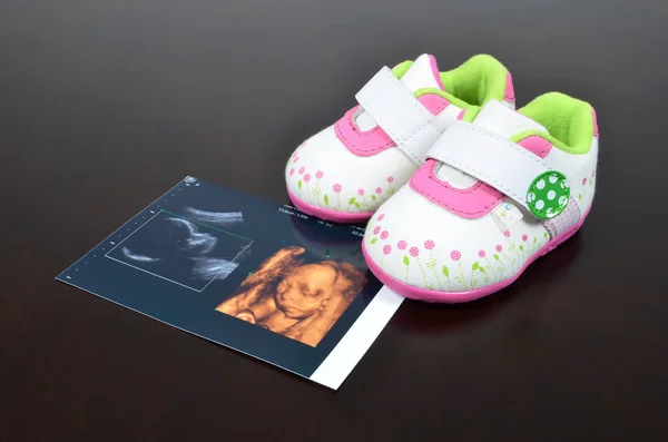 Baby shoe with ultrasound images — Stock Photo, Image