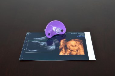 Bebek emziği ultrason görüntüleri