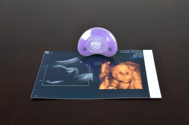 Bebek emziği ultrason görüntüleri