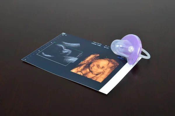 Bebek emziği ultrason görüntüleri — Stok fotoğraf