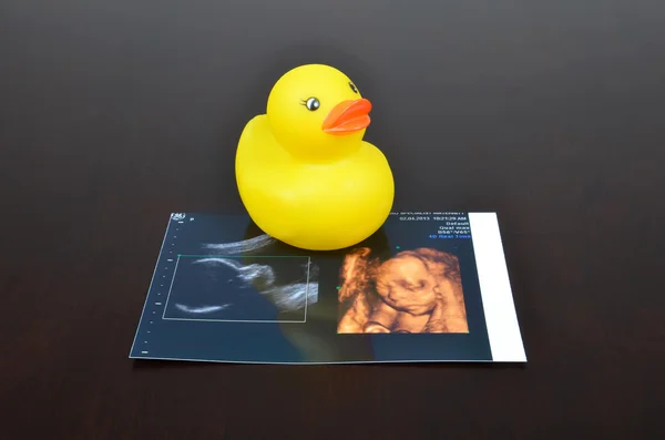 Rubber duck baby toy with ultrasound images — Stock Photo, Image