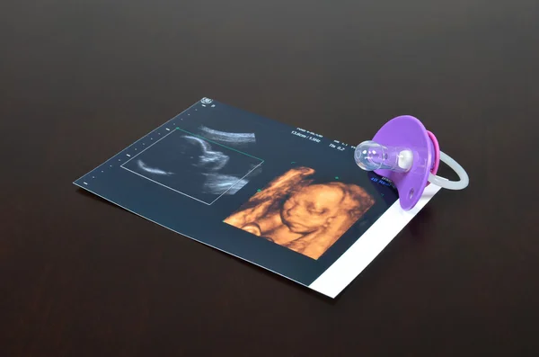 Baby fopspeen met echografie beelden Stockafbeelding