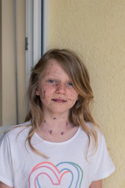 Boyalı lekeli bir kızın portresi savurganlık