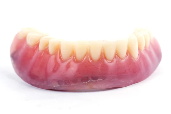 Denti falsi protesi — Foto Stock