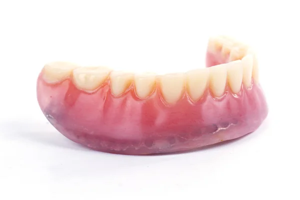 Hamis fogak protézis — Stock Fotó