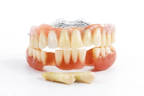 Falsche Zähne prothetisch — Stockfoto