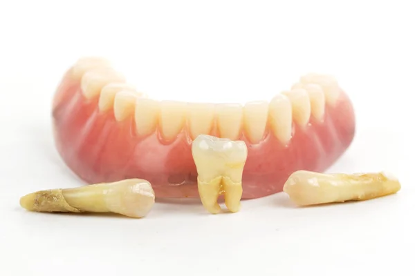 Denti falsi protesi — Foto Stock