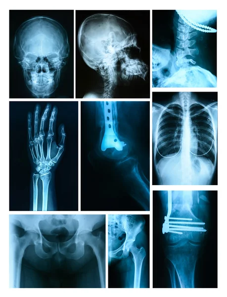 Collage of many X-rays. Very good quality — Stock Photo, Image