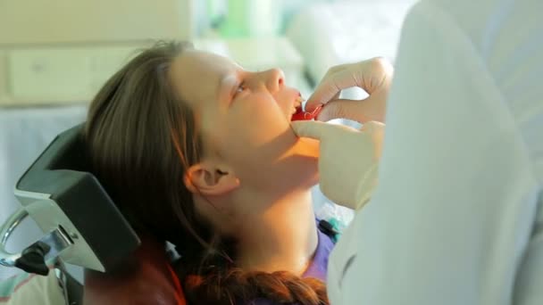 Dentist applying staples in girls mouth — Stock video