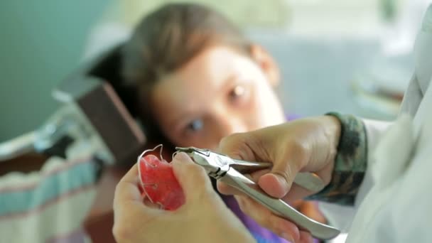 Placa de corrección de pedodoncista para dientes torcidos — Vídeo de stock