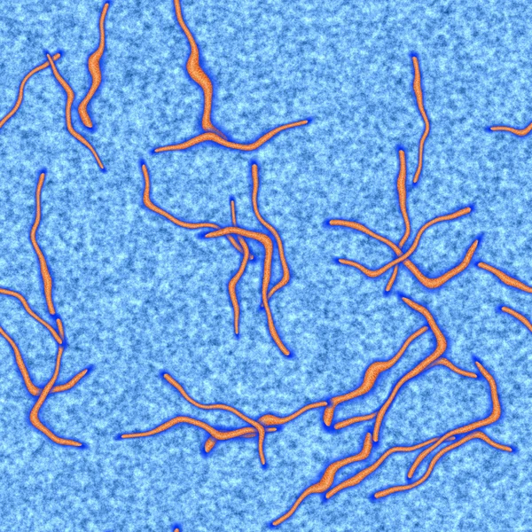 Ebola sorunsuz hires doku oluşturulan