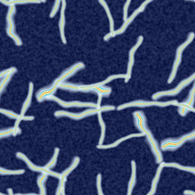 Ebola sorunsuz hires doku oluşturulan