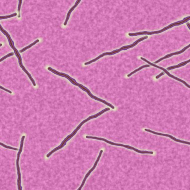 Ebola sorunsuz hires doku oluşturulan