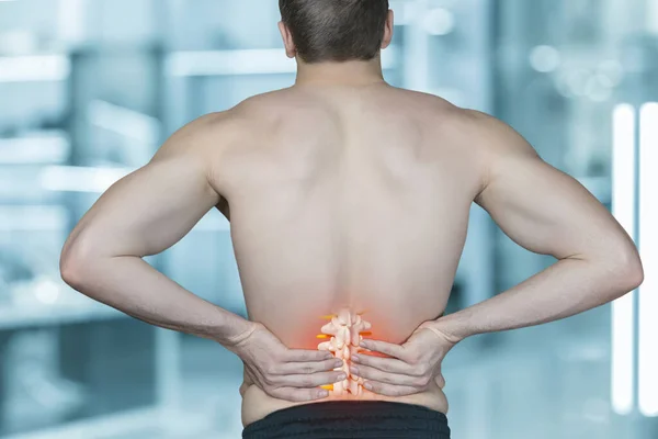 Patient Steht Mit Dem Rücken Und Zeigt Rückenschmerzen Auf Verschwommenem — Stockfoto