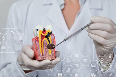 Diş hastalığı tedavisi konsepti. Doktor bulanık bir arkaplanda hastalıklı bir diş örneği tutuyor..