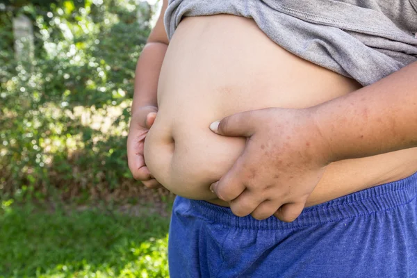 Ragazzo grasso e malsano con sfondo naturale . — Foto Stock