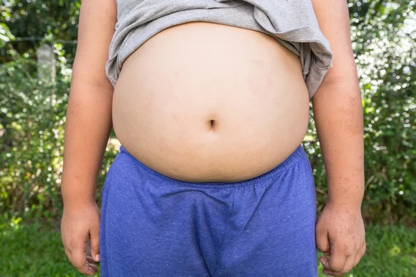 Menino gordo e insalubre com fundo natural . — Fotografia de Stock