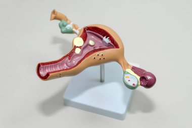 Kadın üreme sisteminin plastik modeli. Yumurtalıklı rahmin anatomik modeli. Kadın üreme sistemi kavramı. Biyoloji eğitimi ve öğretimi için ekipman.