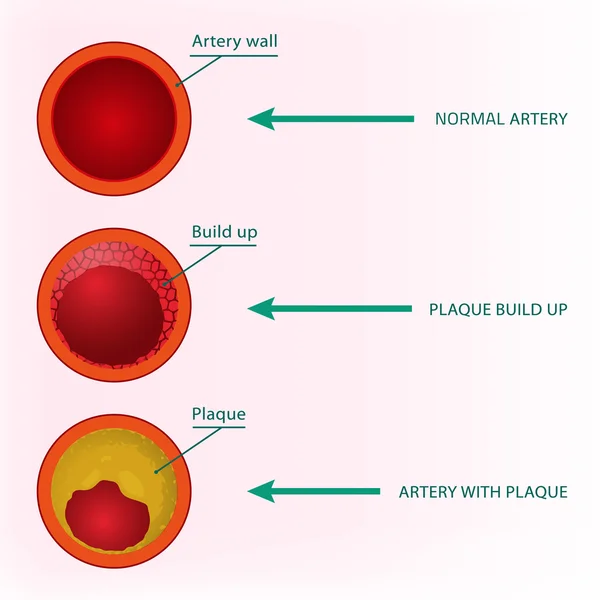 Blood Vector Image — Stock Vector