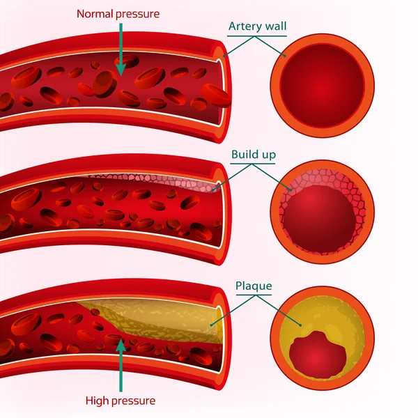 Imagen del vector sanguíneo — Vector de stock