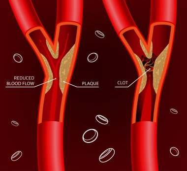 Kan damarı görüntü