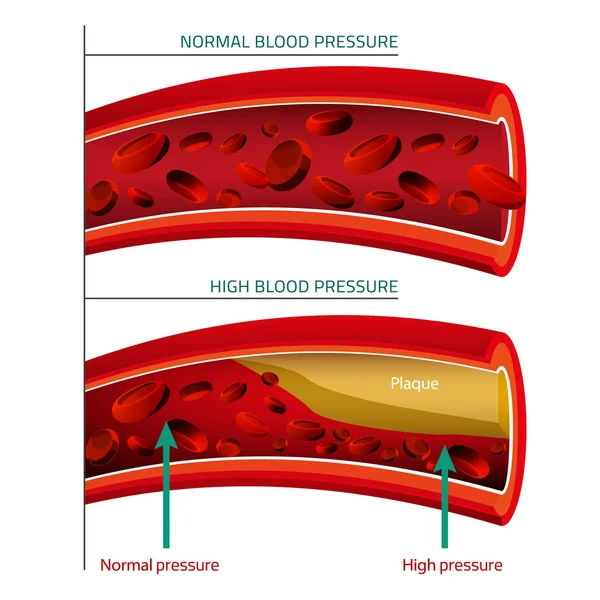 Imagem vetorial de sangue — Vetor de Stock