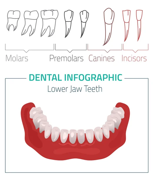 Infográfico vetorial de dentes — Vetor de Stock