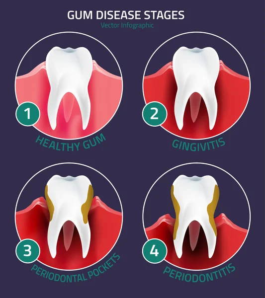 Infographie vectorielle des dents — Image vectorielle
