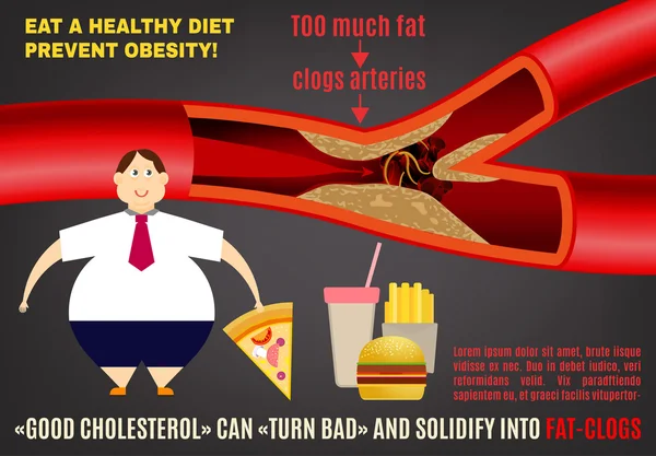 Παχυσαρκία διάνυσμα infopraphics — Διανυσματικό Αρχείο