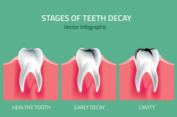 Anatomia do vetor dos dentes —  Vetores de Stock